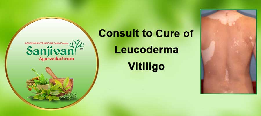 How to Cure White Spots on Skin?